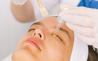 Renueva tu piel con los beneficios del peeling facial